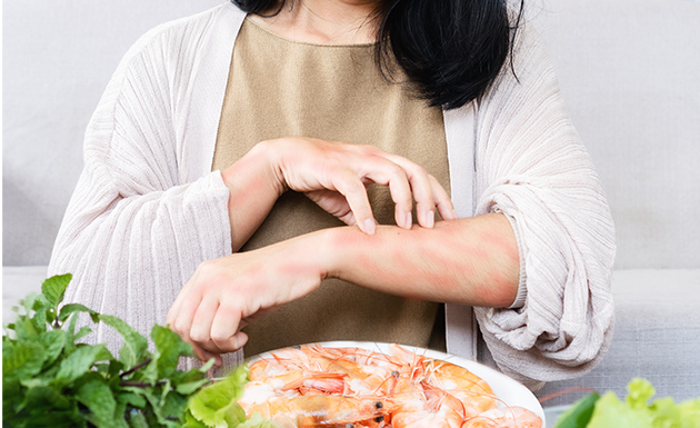 食物アレルギー・口腔アレルギー症候群